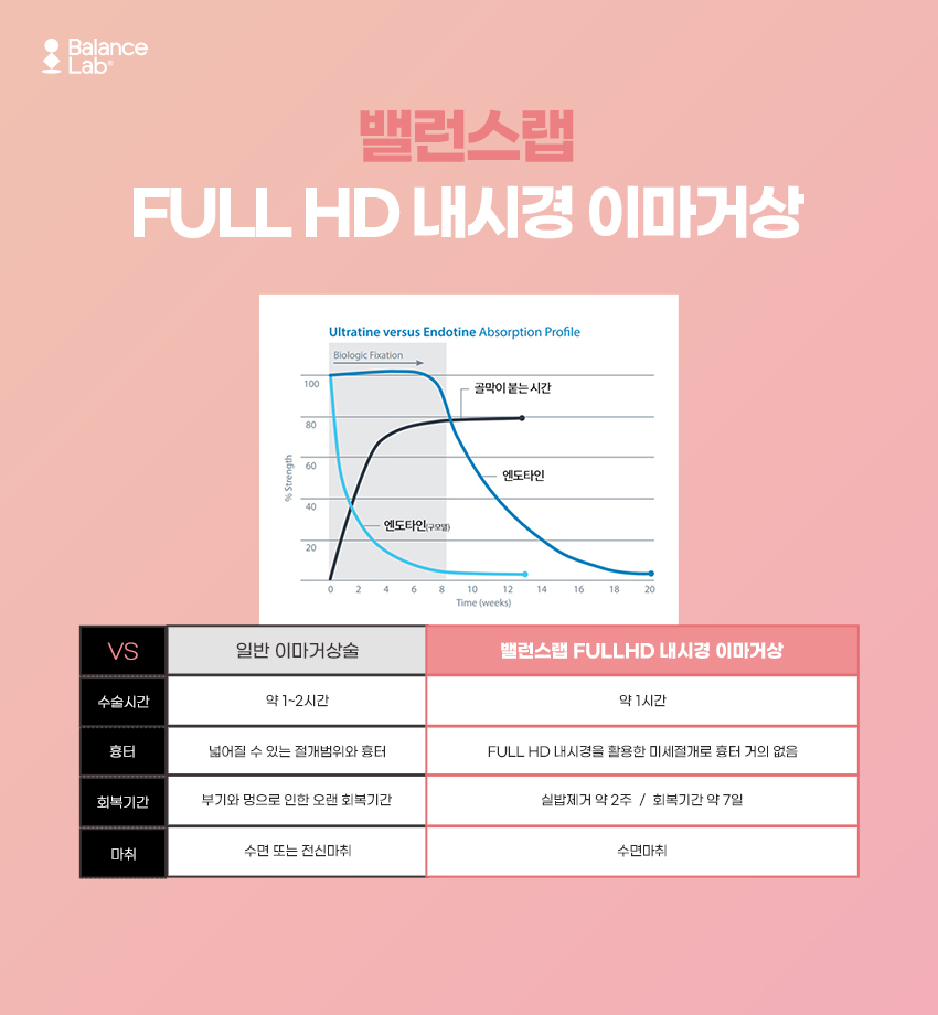 내시경이마거상 알아보고 있다면 유용한 정보들 관련 이미지 3