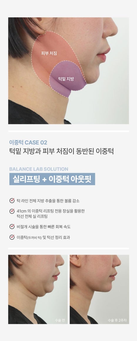 [5월 이벤트] 감사의 달 한정 특가! 아름다움을 선물하세요🎁 관련 이미지 12