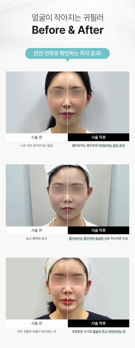 [5월 이벤트] 감사의 달 한정 특가! 아름다움을 선물하세요🎁 관련 이미지 15