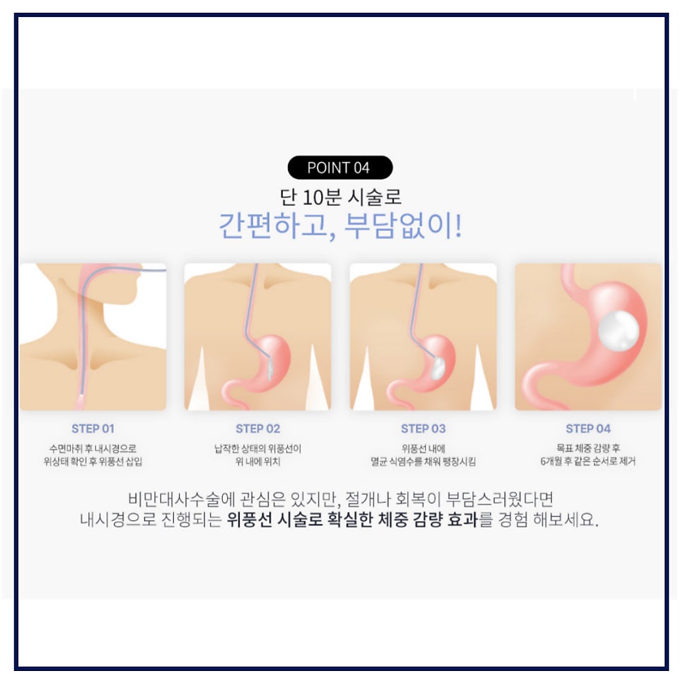 강남 비만치료, 위풍선 다이어트로 -8kg 감량 관련 이미지 4
