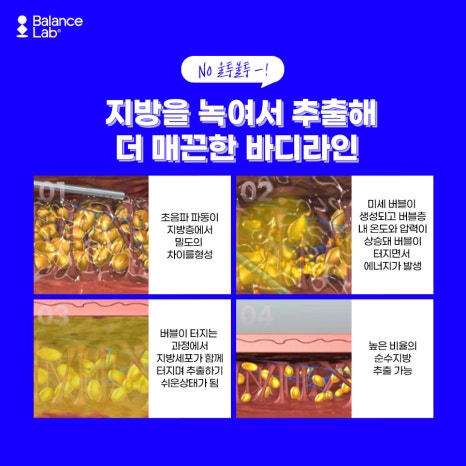 신사역 허벅지지방추출주사 후기로 체크해보는 정보 ! 관련 이미지 5