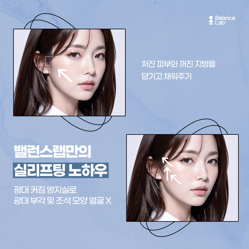 Things You Should Know Before Visiting a Gangnam Thread Lift Plastic Surgery Clinic! image 3