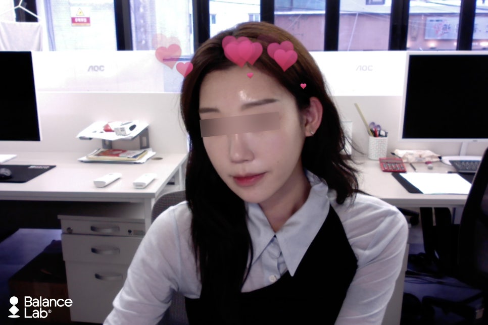 신사역 투명브이리프팅으로 얼굴 쫙 땡긴 실리프팅 후기 관련 이미지 1
