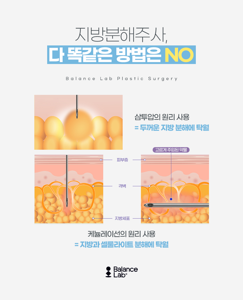 밸런스랩성형외과의 팔뚝과 부유방 빠지는 지방분해주사 후기 관련 이미지 4
