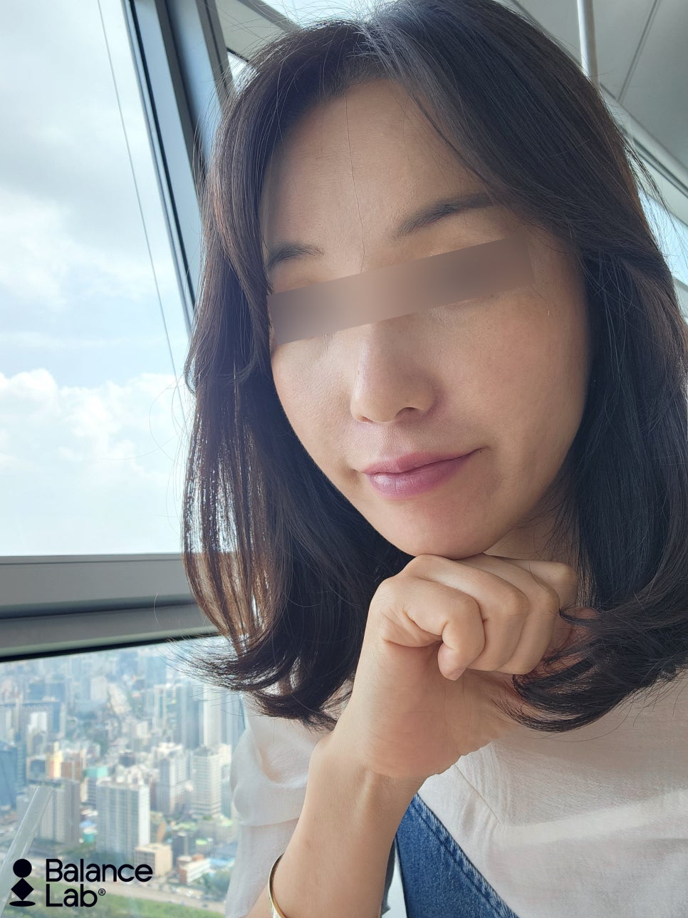 안면거상 하고 다시 온 처짐, 투명 브이 실리프팅으로 올려요 관련 이미지 1