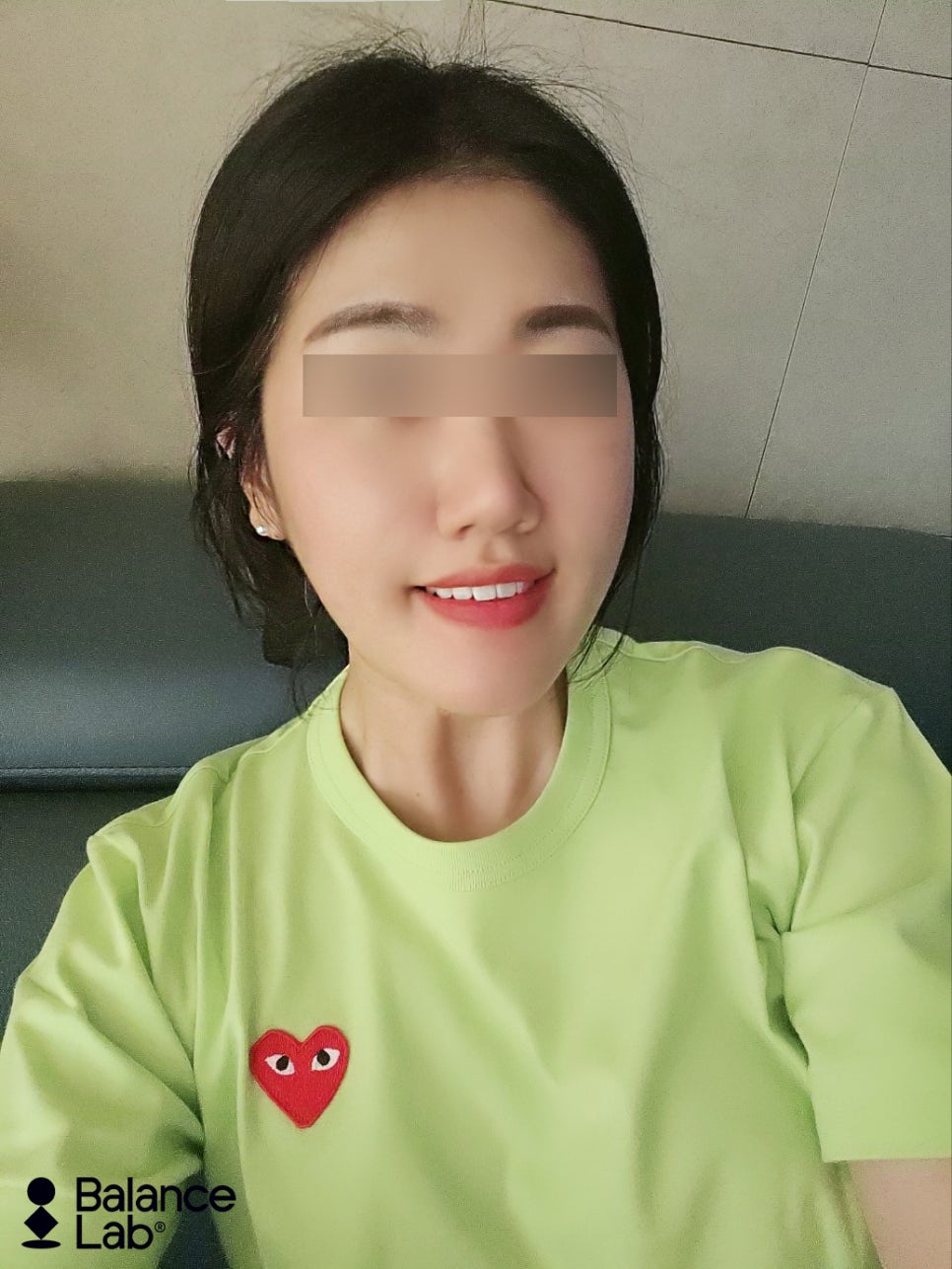 오래가는 라포엘 실 리프팅 효과 직접 체험해보니 관련 이미지 1