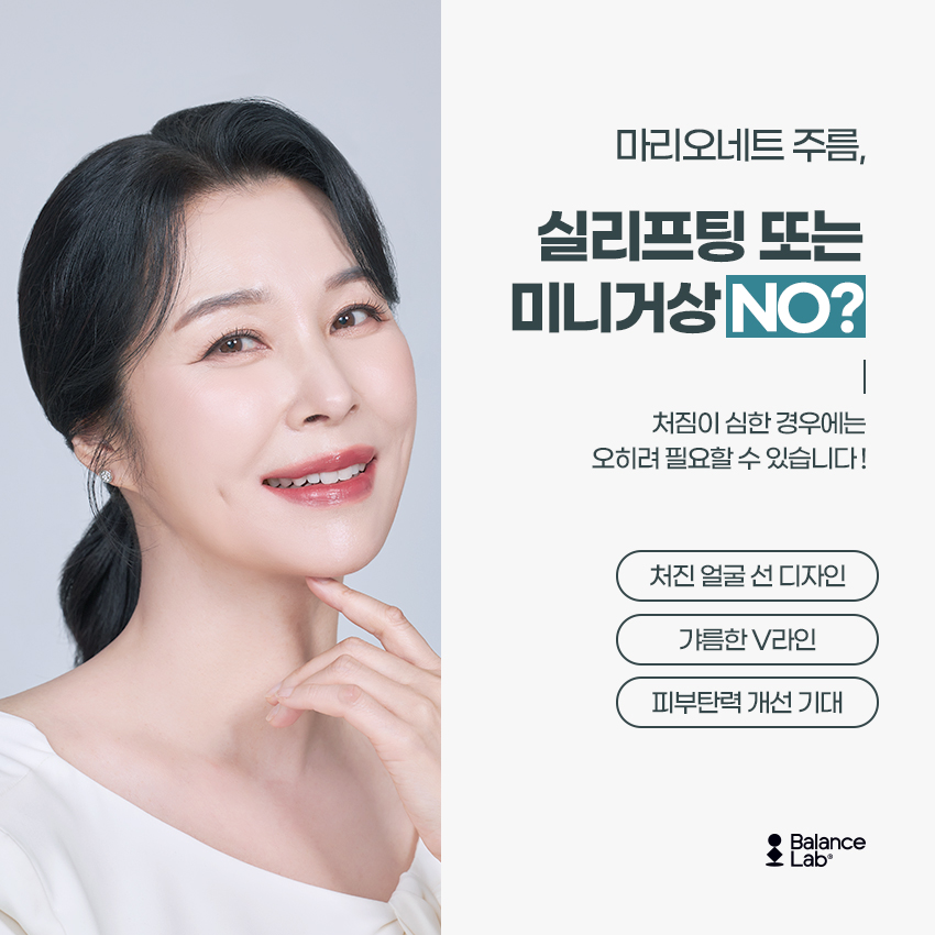 Is Marionette Filler Effective for Removing Lines Around the Mouth and Nasolabial Folds? image 5