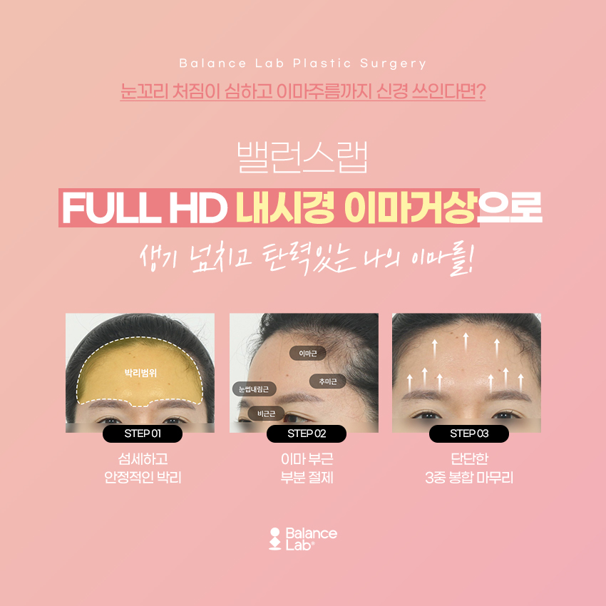 내시경이마거상 알아보고 있다면 유용한 정보들 관련 이미지 4