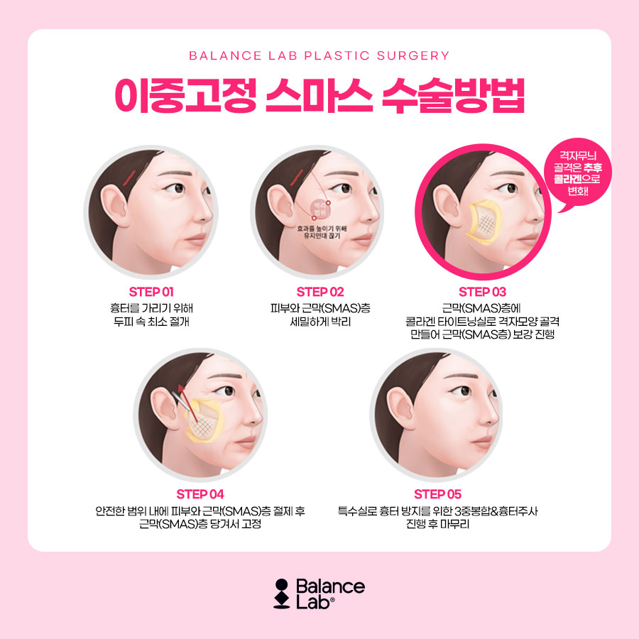 처짐 고민이 시작되는 30대, 미니거상 수술로 꽉 잡아주기✨ 관련 이미지 3