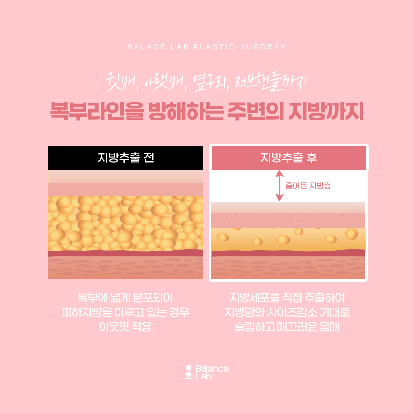 복부살빼기 효과를 원하는 방법 아웃핏후기를 찾아보자 관련 이미지 4