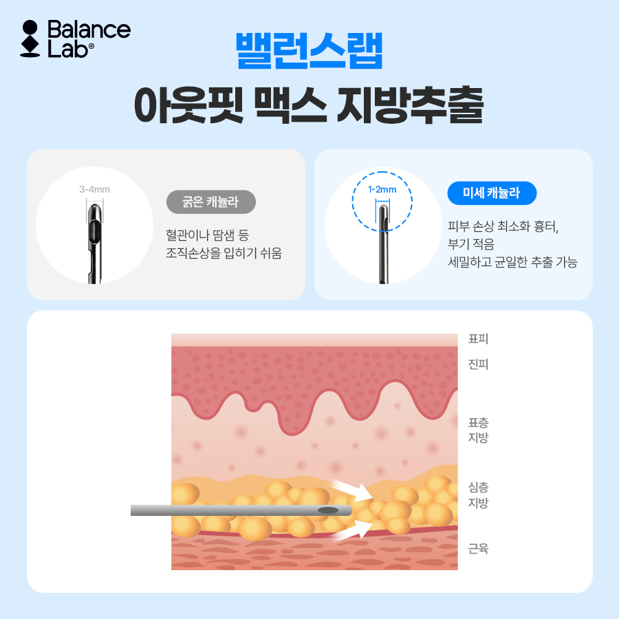 뱃살빼는법, 운동만으로 안 빠진다면? 복부지방흡입과 지방추출주사 관련 이미지 8