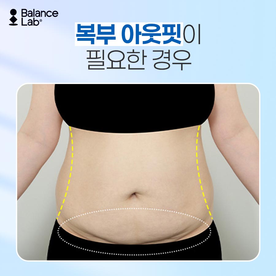 지방분해주사 vs 지방추출주사 차이점과 효과｜밸런스랩 관련 이미지 5