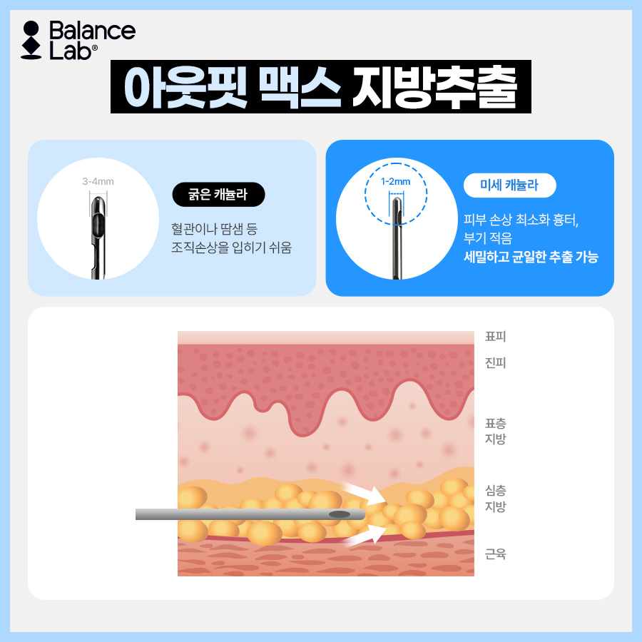 끝까지 안 빠지는 승마살, 허벅지지방추출주사로 허벅지살빼는법 관련 이미지 5
