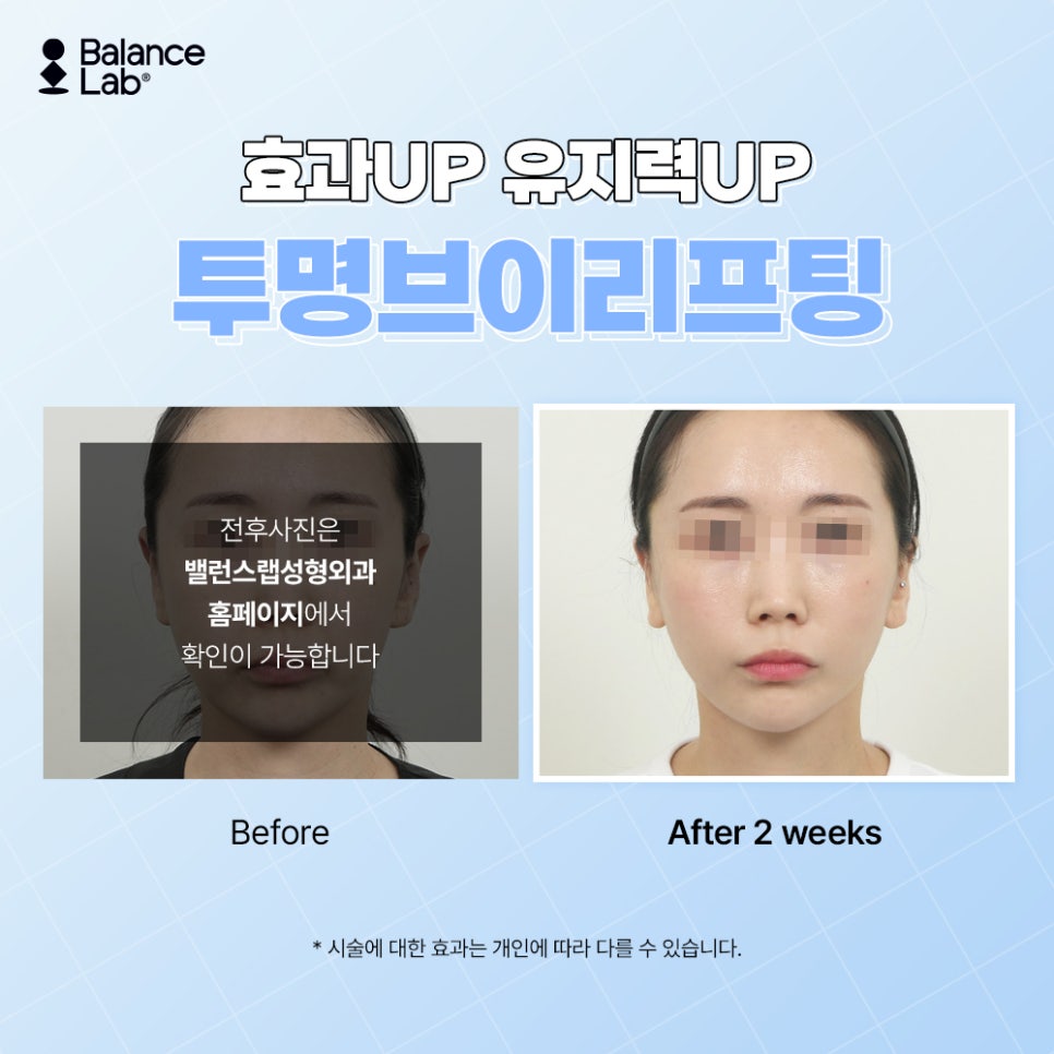 I got a lifting treatment at Balance Lab that completely corrected sagging after contouring surgery image 5