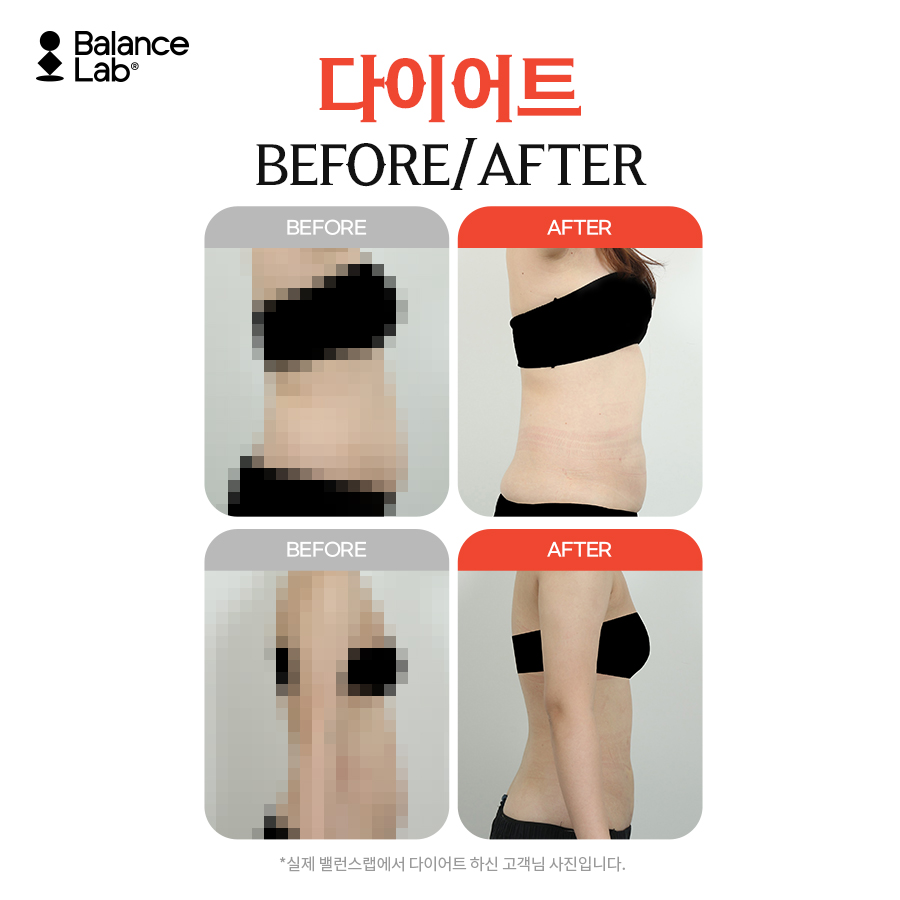 Will You Lose Weight If You Get a Diet IV Drip? image 7