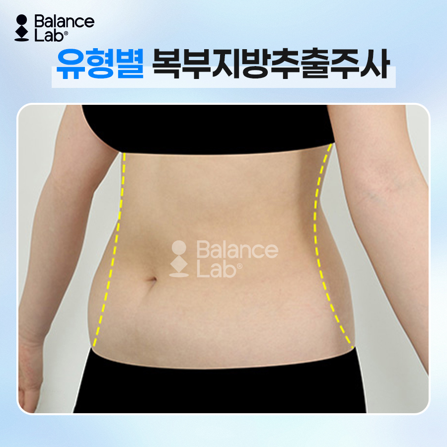 뱃살빼는법, 운동만으로 안 빠진다면? 복부지방흡입과 지방추출주사 관련 이미지 4