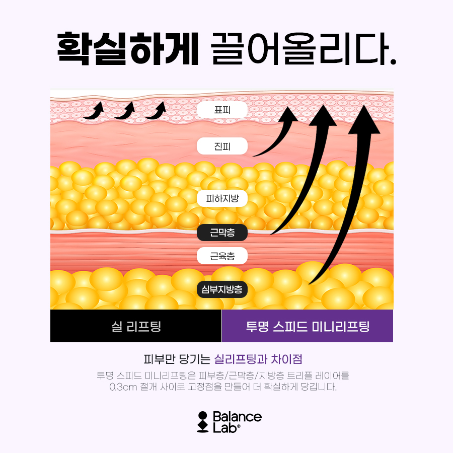 투명한 흉터로 스피드 리프팅! 미니리프팅 병원에서😉 관련 이미지 4