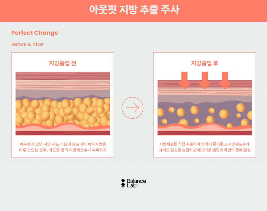 지방분해주사패키지 다가오는 여름휴가를 위하여 관련 이미지 6