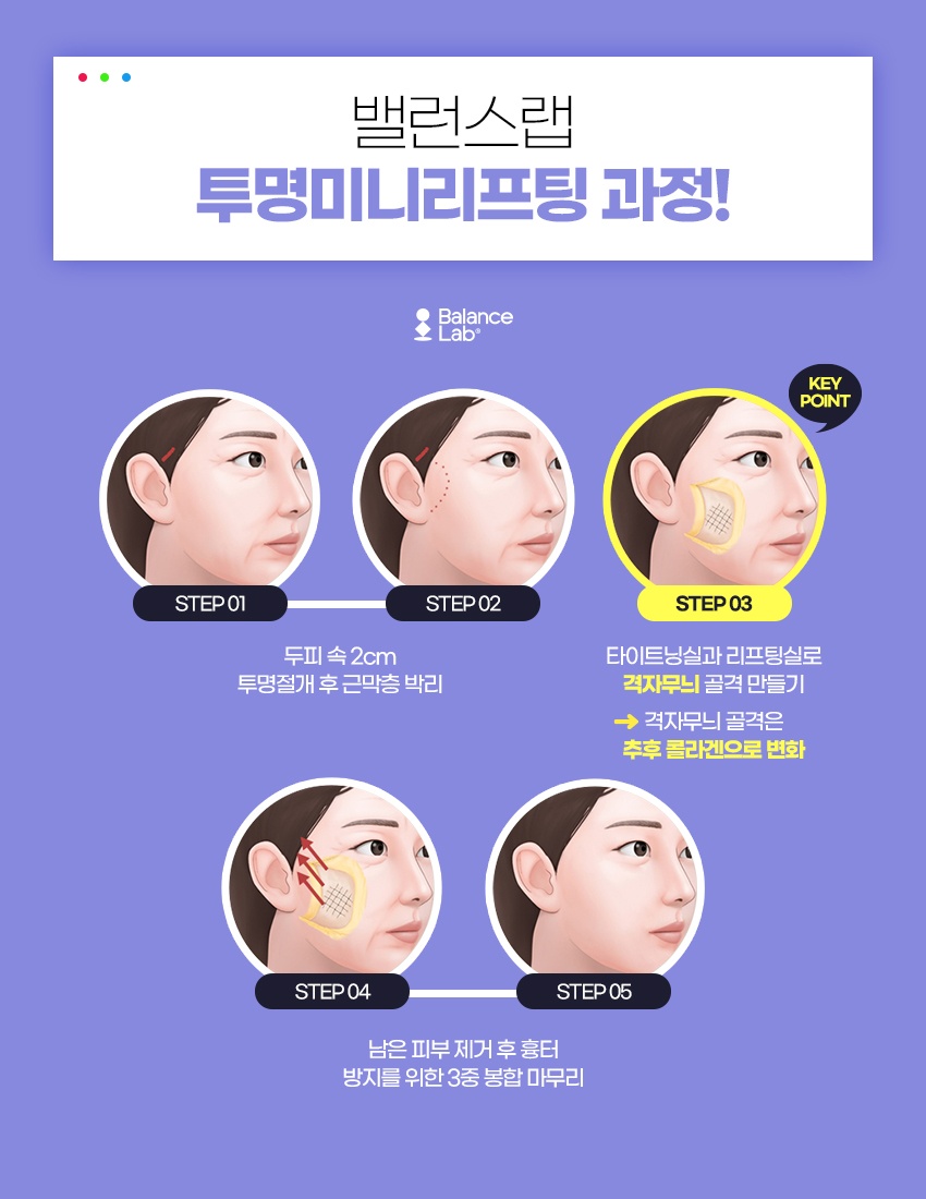 V-Line Lifting: Transparent Mini Lifting Effects That Can Help Restore Firm Skin image 5