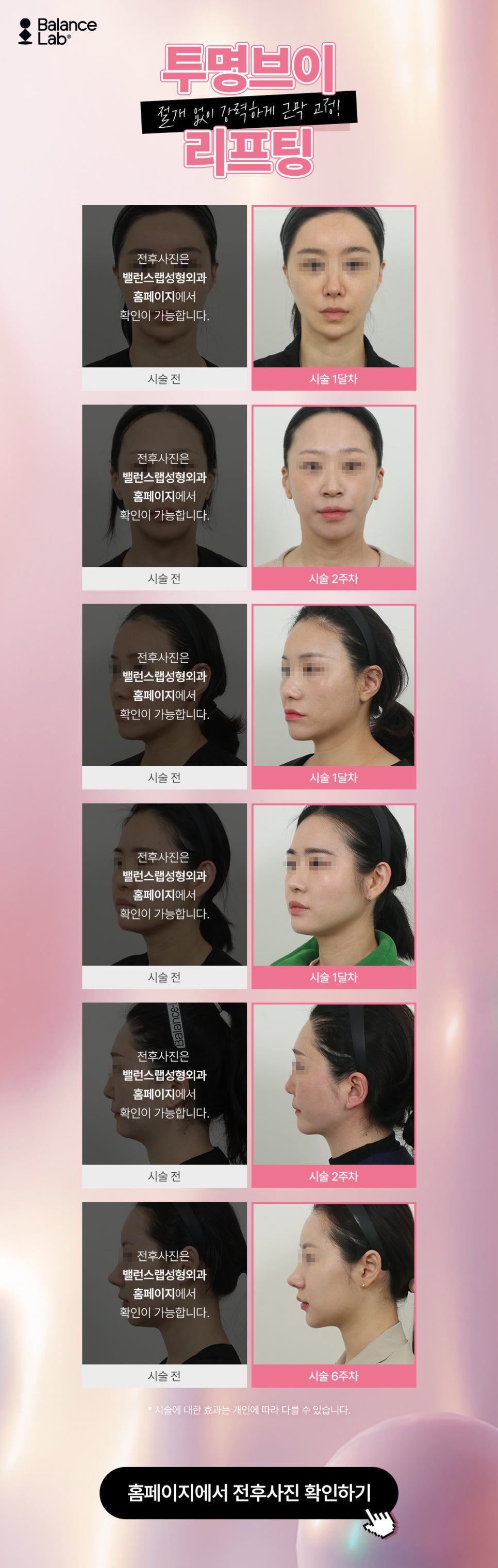 얼굴 실리프팅 오래 유지하는 효과적인 방법 관련 이미지 7
