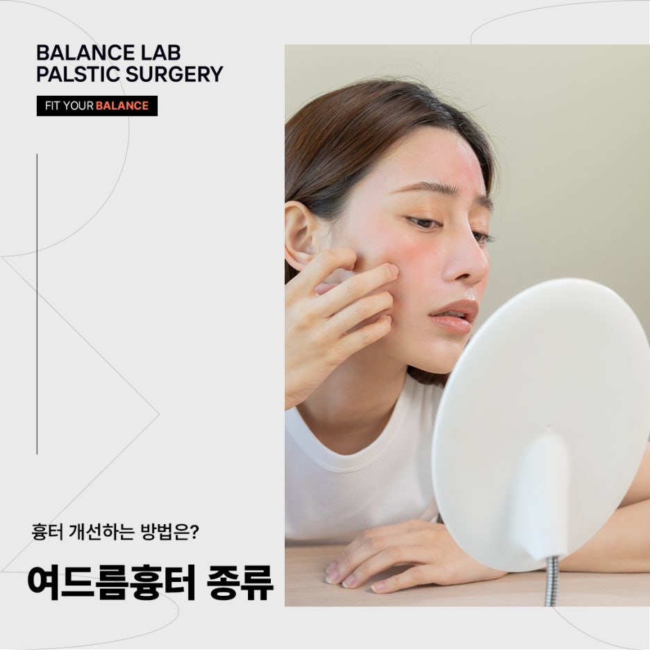 Types of Acne Scars, and How Can You Improve Scars? image 1