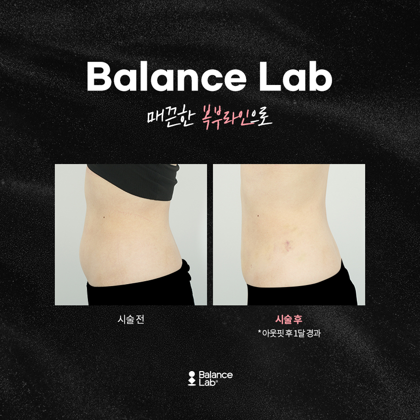 복부살빼기 효과를 원하는 방법 아웃핏후기를 찾아보자 관련 이미지 3