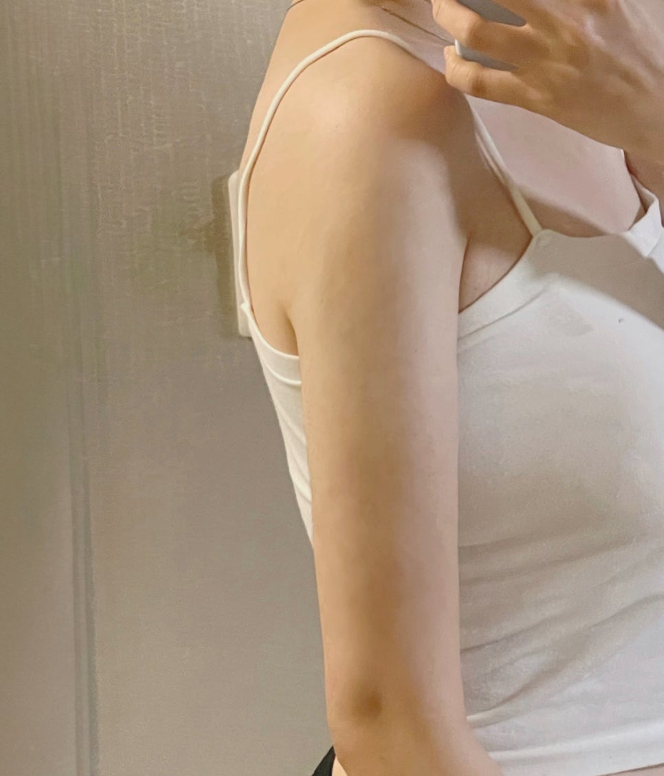 위고비 주사 가격, 후회 없는 선택을 하려면?🎀 관련 이미지 6