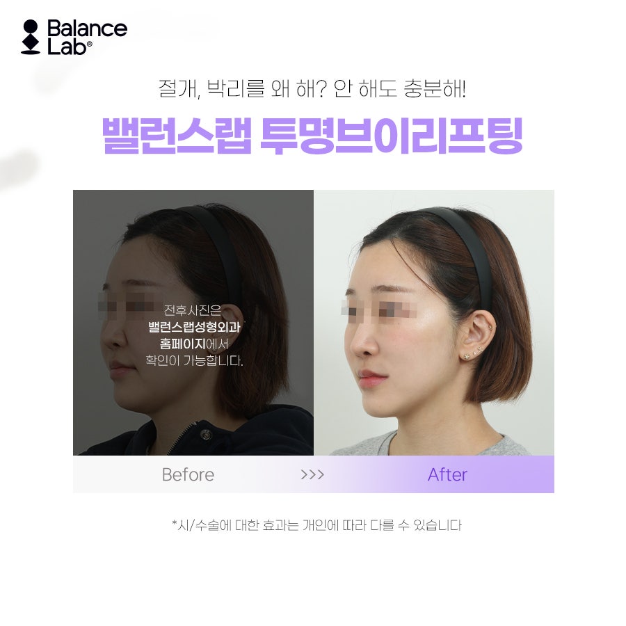 Thread lifting that really works on the jawline? It’s Balance Lab’s Transparent V Lifting💓 image 5