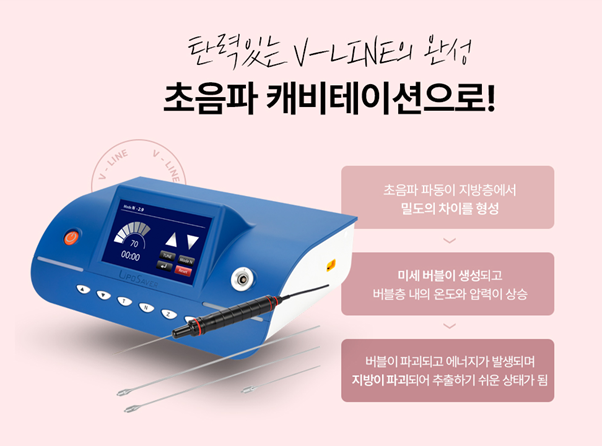 둔해 보이는 턱살, 신사이중턱지방추출로 개선해 보자 관련 이미지 4