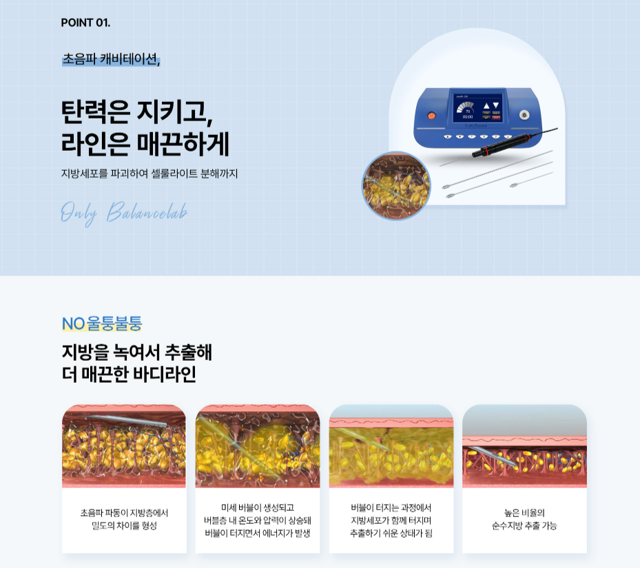 슬림한허리라인 복부지방추출주사로 가능하다면 관련 이미지 2