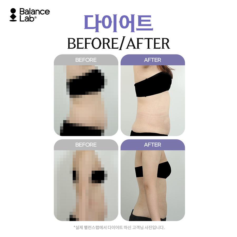 다이어트수액으로 건강하게 체중 감량하자 관련 이미지 7