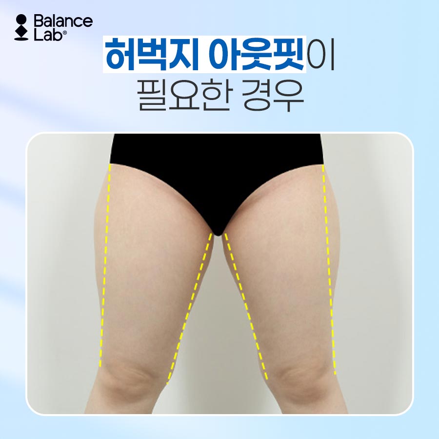 지방분해주사 vs 지방추출주사 차이점과 효과｜밸런스랩 관련 이미지 6