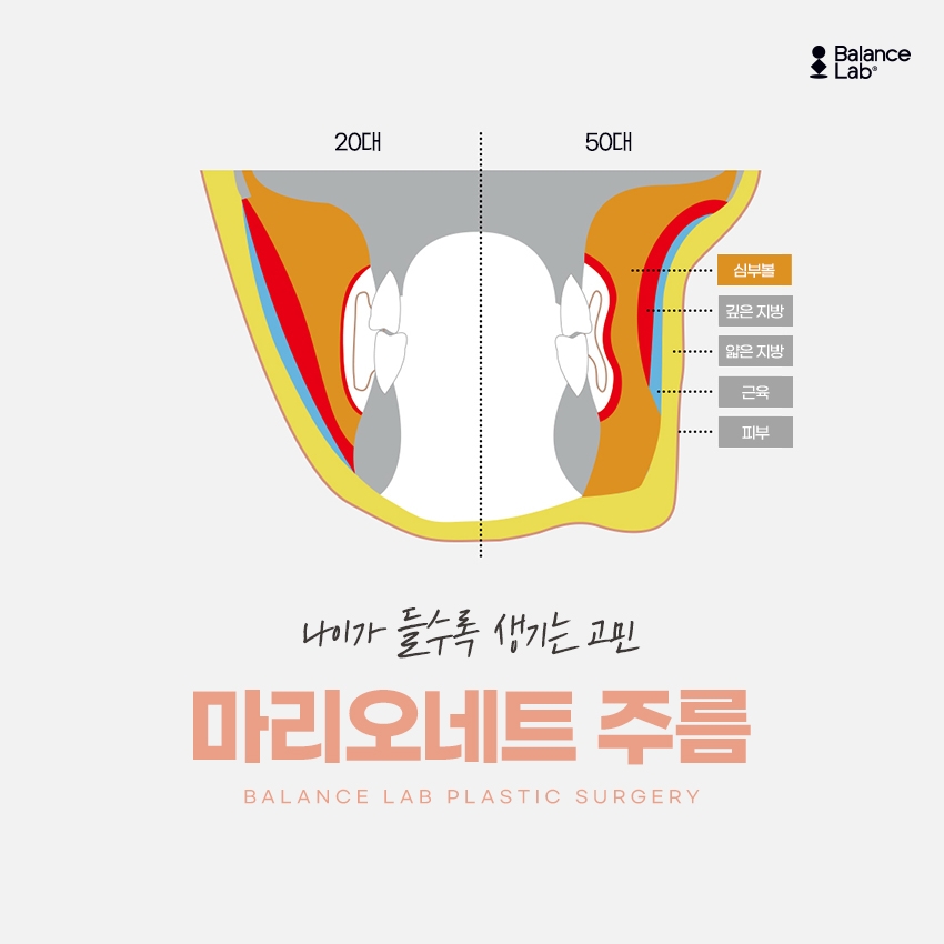 심부볼제거수술로 볼살빼기 하는방법은 관련 이미지 5
