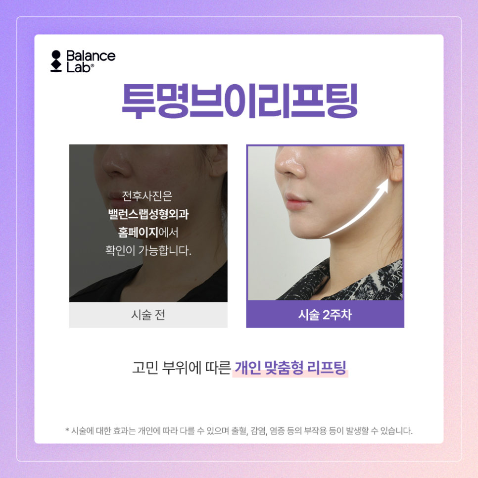 강남실리프팅 비교하기: 왜 투명브이리프팅일까 관련 이미지 4