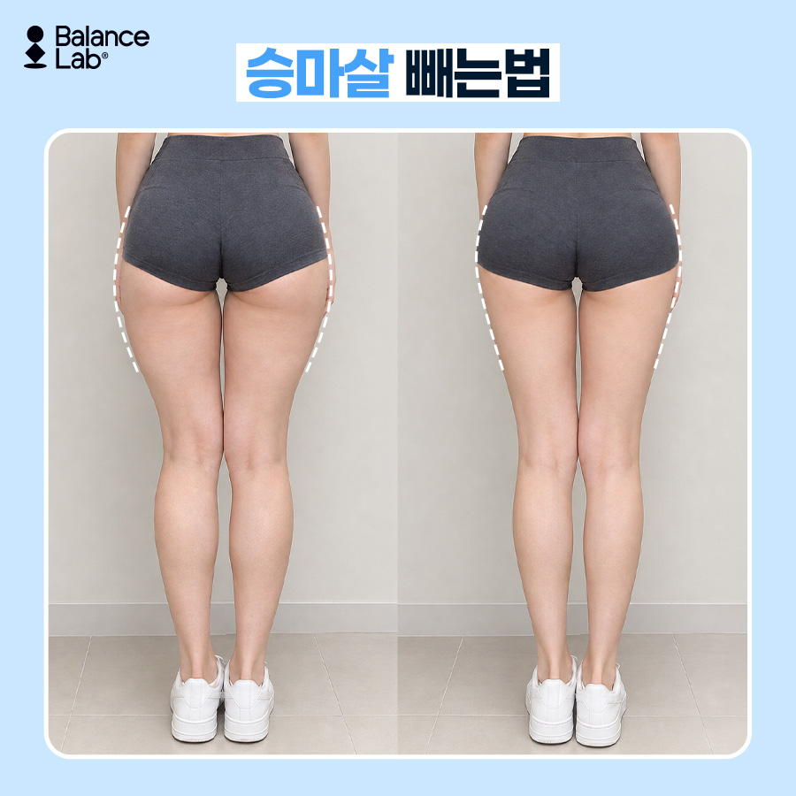 끝까지 안 빠지는 승마살, 허벅지지방추출주사로 허벅지살빼는법 관련 이미지 3