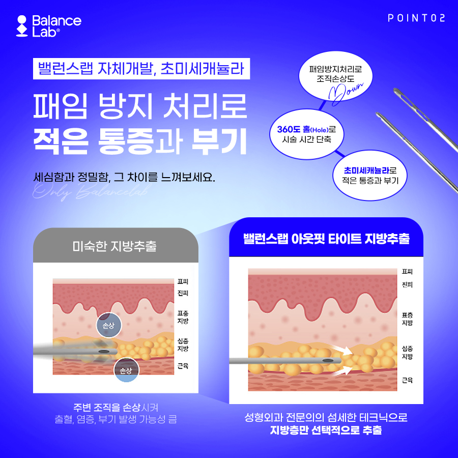 신사역 허벅지지방추출주사 후기로 체크해보는 정보 ! 관련 이미지 6
