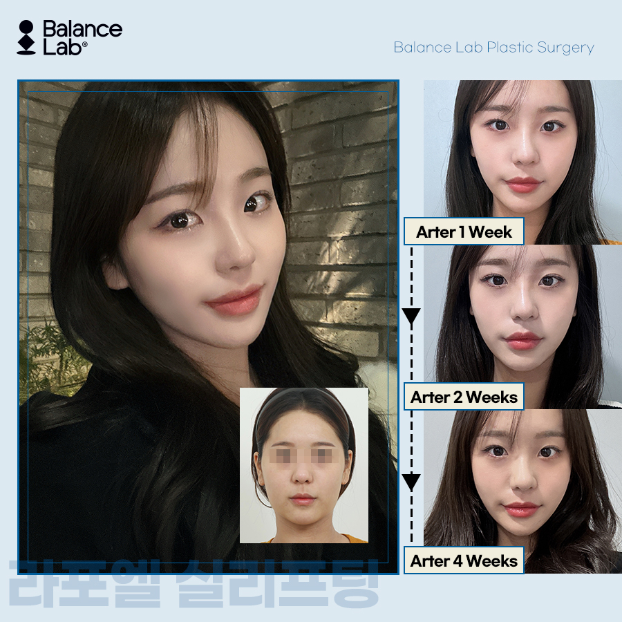 실리프팅 효과 제대로 보고 싶다면 라포엘 투명 브이 리프팅으로 관련 이미지 2