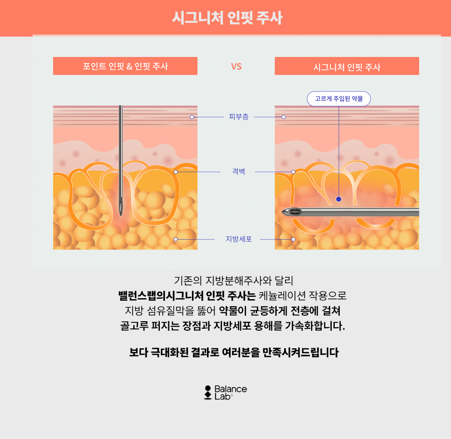 부위별로 감량이 가능한 신사지방분해주사 관련 이미지 10