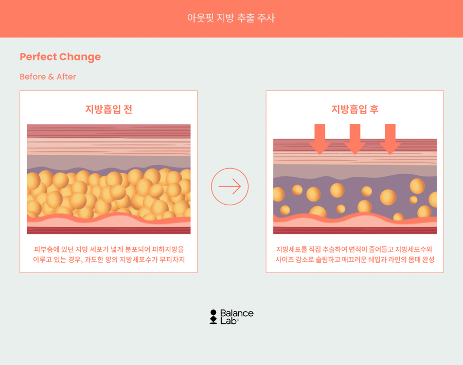 Fat Extraction Injection Effect: If You’re Looking for a Diet Cheat Code✨ image 4