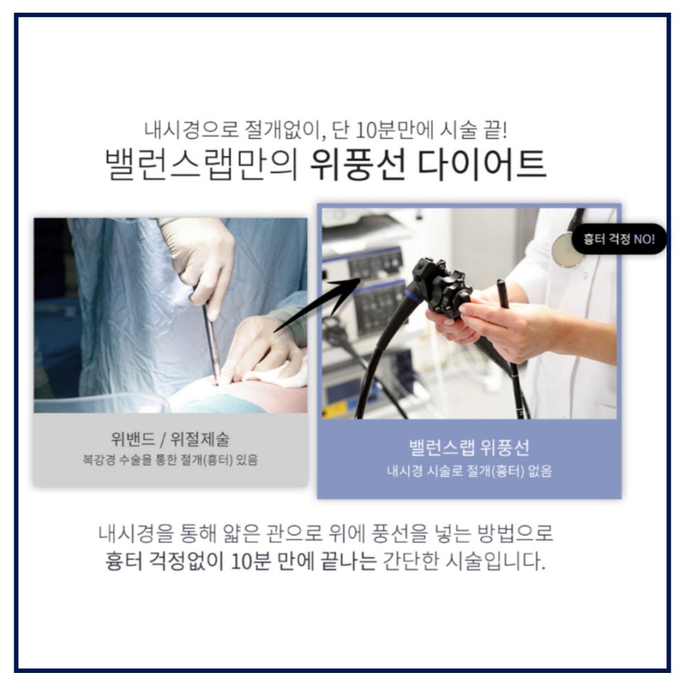 강남 비만치료, 위풍선 다이어트로 -8kg 감량 관련 이미지 2