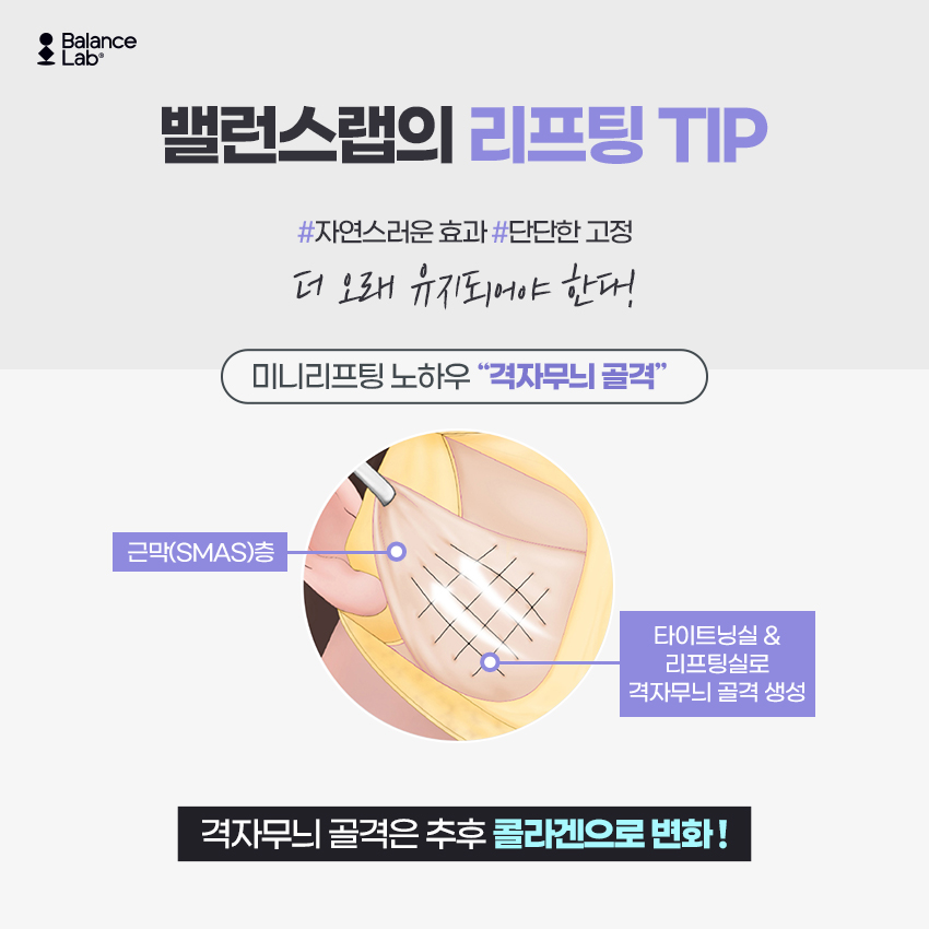 처진 턱라인 미니거상으로 리프팅 할 때 가격과 효과 안 중요한게 없어요 관련 이미지 5