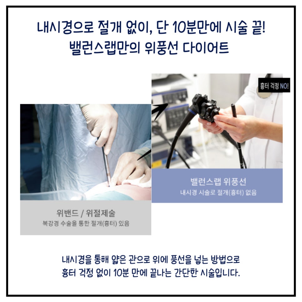 위풍선다이어트, 식이조절 해서 체중감량 했어요. 관련 이미지 7