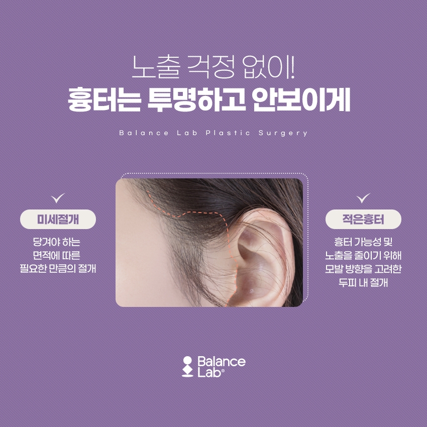 미니거상술과 복합적인 이중고정스마스리프팅을 원한다면 관련 이미지 7