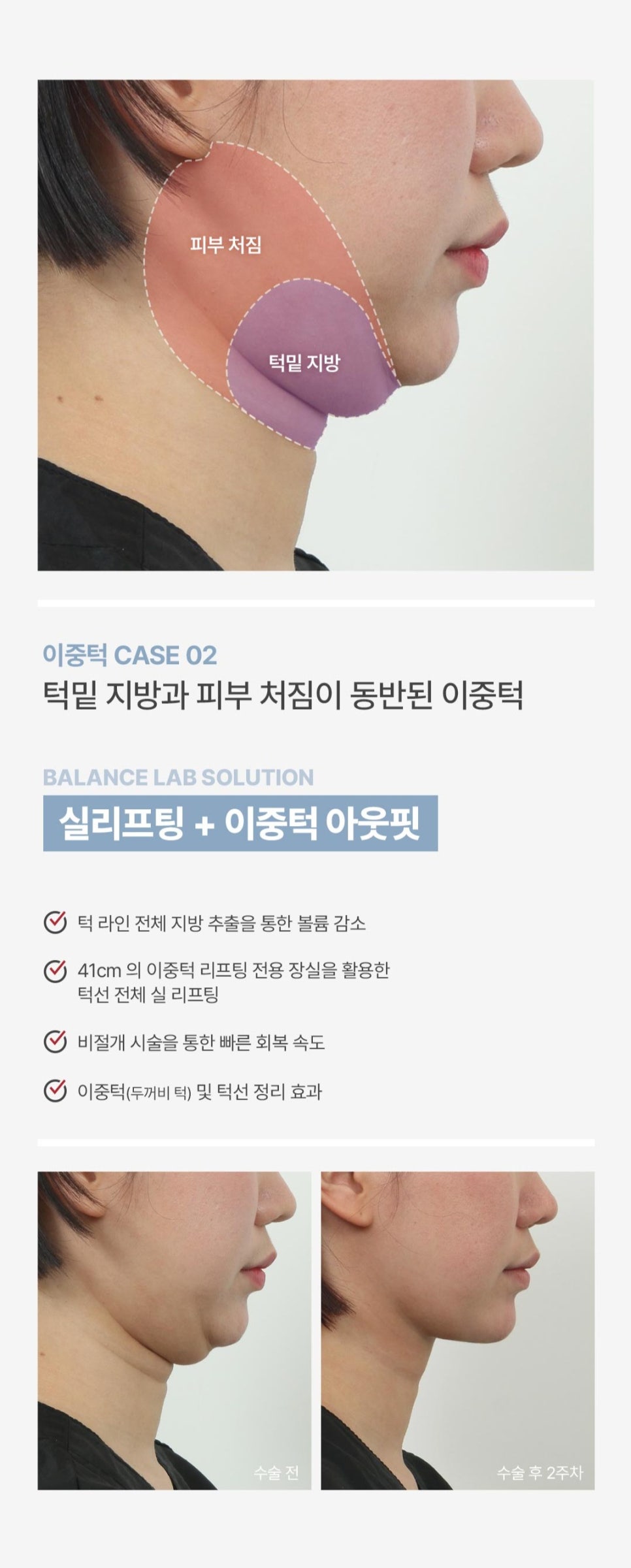 봄격적으로 예뻐지는 밸런스랩 🌸봄.격.할.인🌸 4월 이벤트 보러가기 관련 이미지 11