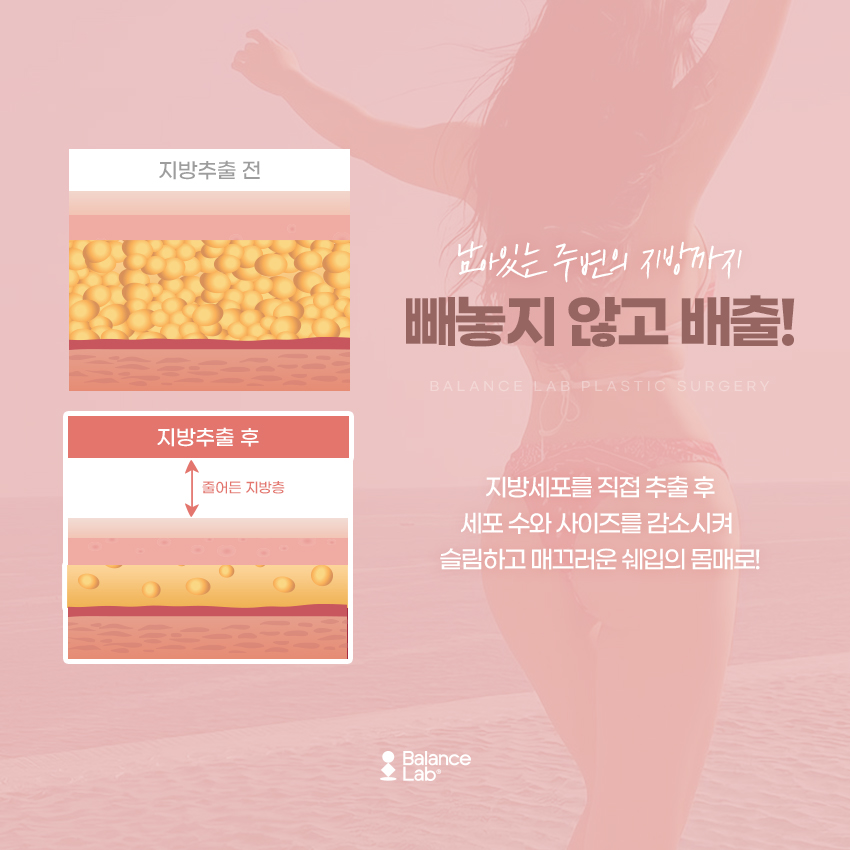 What Is the Fat-Removal Procedure for Cellulite Treatment? image 4
