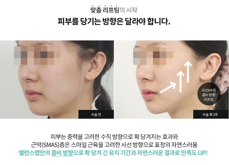 [6월 이벤트] 벌써부터 후끈한 날씨, 여름준비를 시작되었다!! 관련 이미지 9