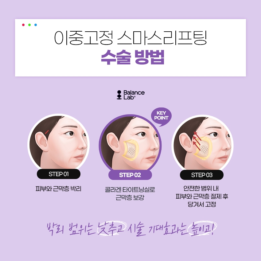 미니거상술과 복합적인 이중고정스마스리프팅을 원한다면 관련 이미지 5