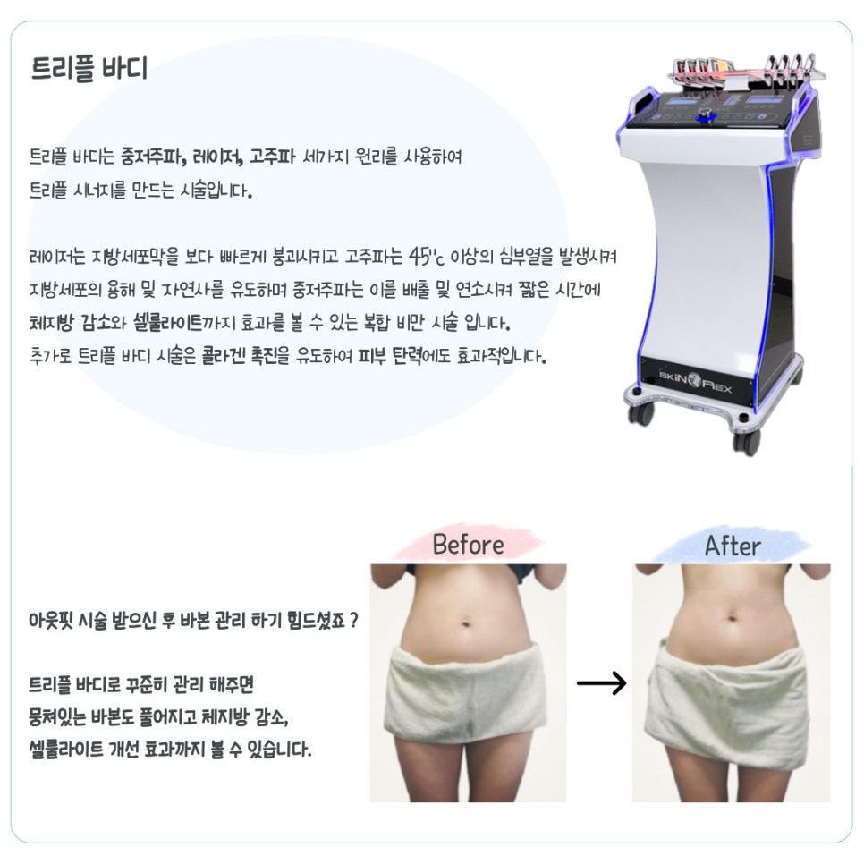 신사역지방추출주사, 팔뚝살이 고민이라면 관련 이미지 8