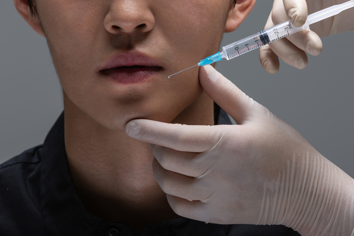 Chin Filler: What Are the Retention Period, Recovery Period, and Precautions? image 2