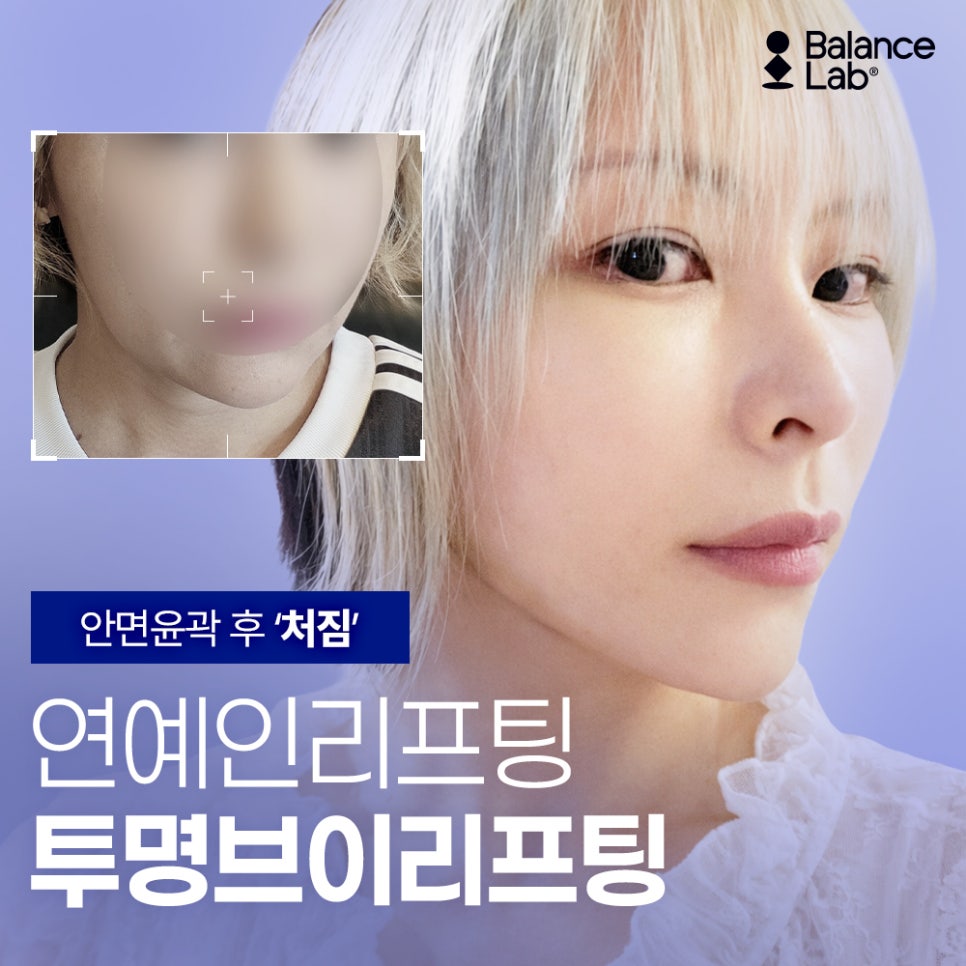 안면윤곽 후 처짐, 투명브이리프팅이 고려되는 이유 관련 이미지 1